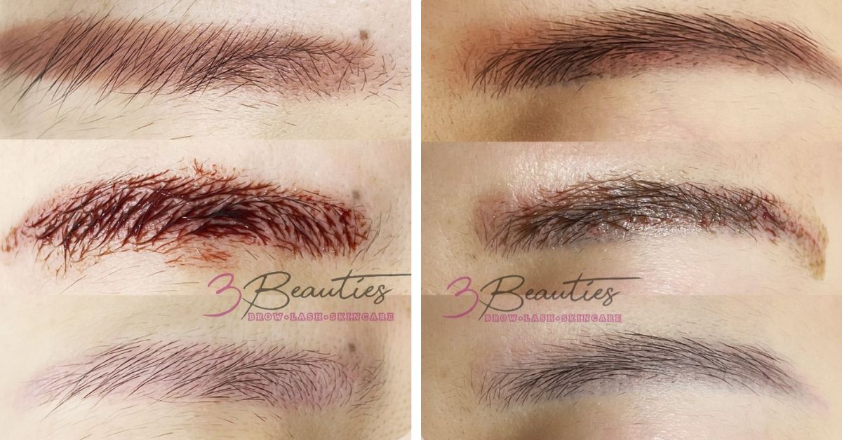 3Beauties&nbsp; - PhiRemoval and NanoPulse