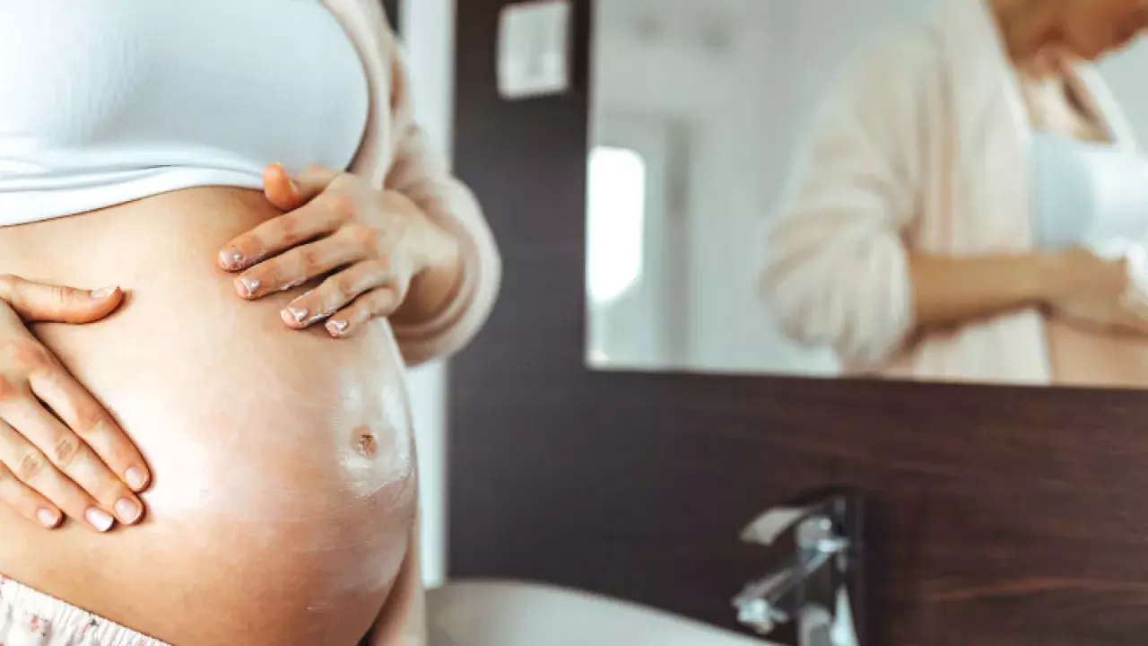 Best Stretch Mark Creams, Serums and Oils in Singapore