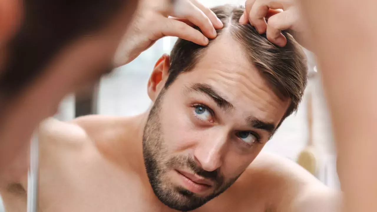 Top Hair Loss Shampoos and Hair Regrowth Products For Men in Singapore