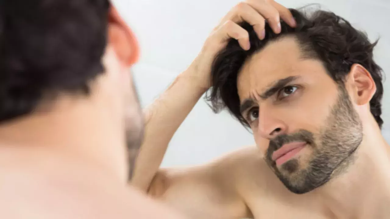 Top Hair Loss Solutions in Singapore for Men To Combat Balding, Thinning Hair, and Receding Hairlines