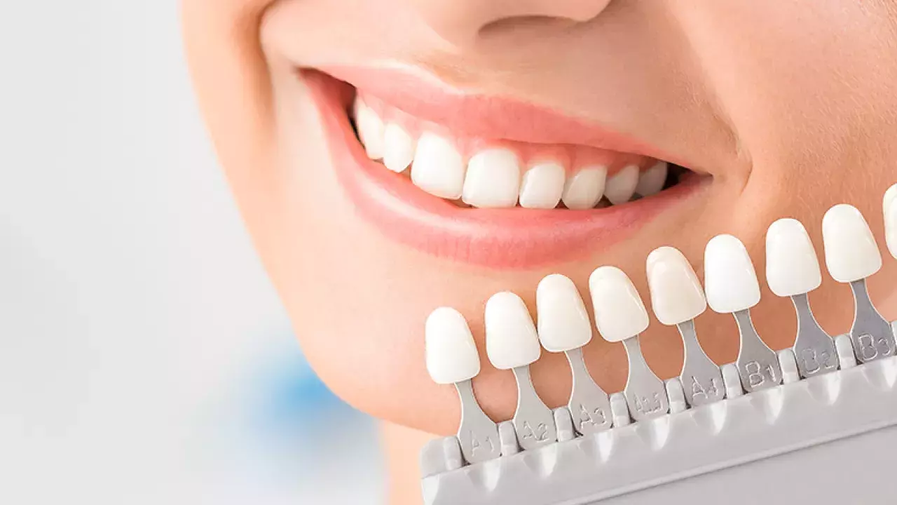 Dental Clinics in Singapore for Teeth Whitening - Banner